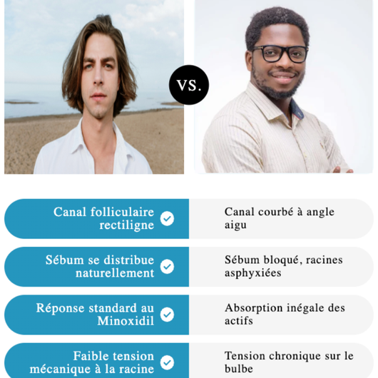 Micro Infusion sur Homme Noir  - Derma Afro